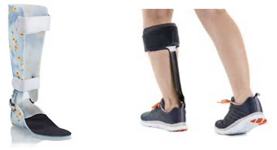 Ankle Foot Orthosis (AFO) at Tailwind Bracing & Orthotics