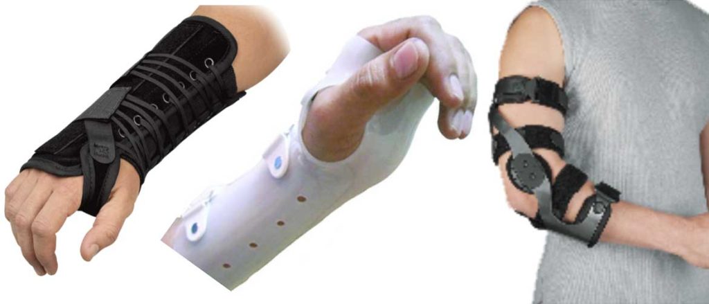 Upper extremity Bracing
